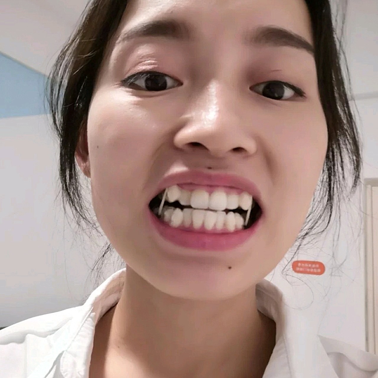 莊最新牙齒技術揭秘,牙齒美容新選擇